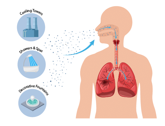 legionella